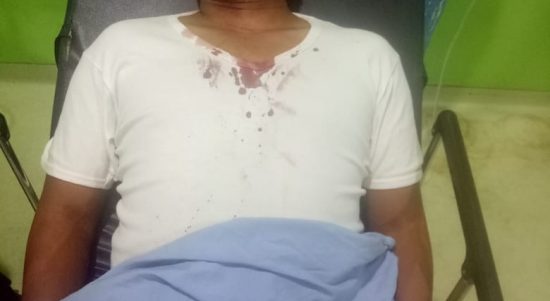 Salah satu penumpang dengan luka robek dikepala akibat laka tunggal Innova di ruas jalan tol.