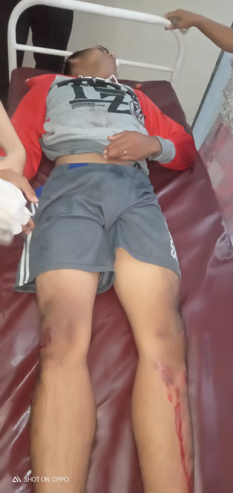 AS alias Adi mendapatkan perawatan di Klinik Az-Zahra  Desa Sei Buluh setelah ditabrak oleh mobil Toyota.
