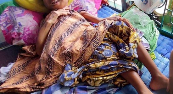 Rismalena (33) warga Dusun 13 Meteran Desa Firdaus Kecamatan Sei Rampah,hanya bisa terbaring karena penyakit yang dideritanya sembari menanti bantuan dari pemerintah.