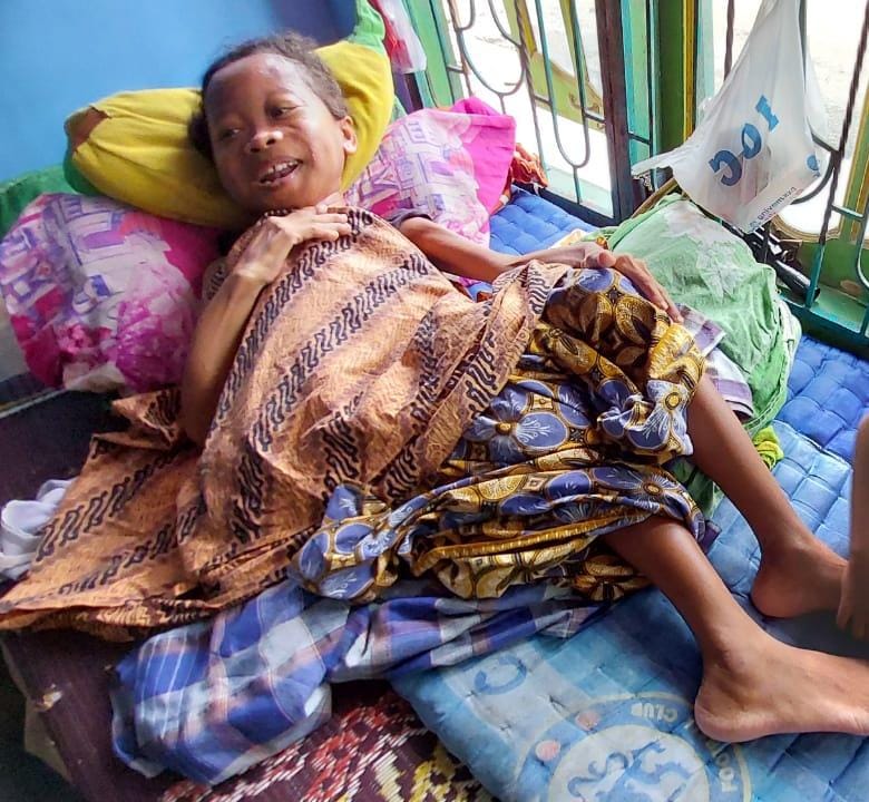 Rismalena (33) warga Dusun 13 Meteran Desa Firdaus Kecamatan Sei Rampah,hanya bisa terbaring karena penyakit yang dideritanya sembari menanti bantuan dari pemerintah.