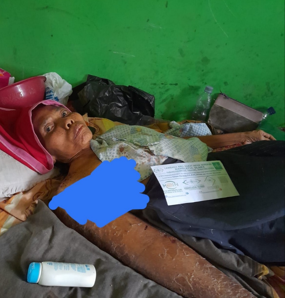 Ibu Kimariah Pulungan yang terkulai lemah di tempat pembaringannya karena sakit kanker payudara yang dideritanya sudah dua tahun.