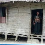 Sebelum dibedah