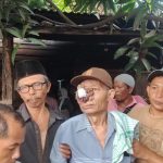 Ali Napia Pengidap penyakit tumor mata asal desa Simaninggir diberangkatkan berobat ke kota medan.
