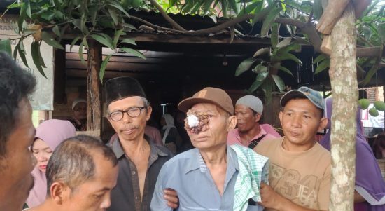 Ali Napia Pengidap penyakit tumor mata asal desa Simaninggir diberangkatkan berobat ke kota medan.