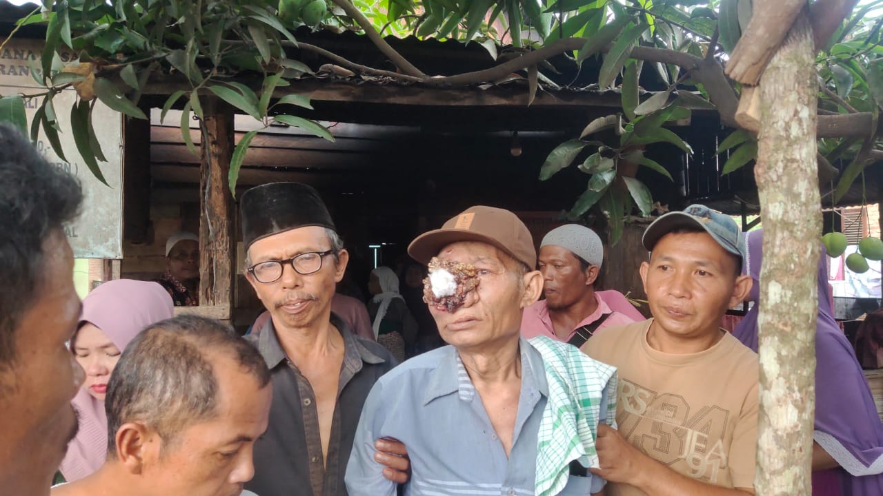 Ali Napia Pengidap penyakit tumor mata asal desa Simaninggir diberangkatkan berobat ke kota medan.